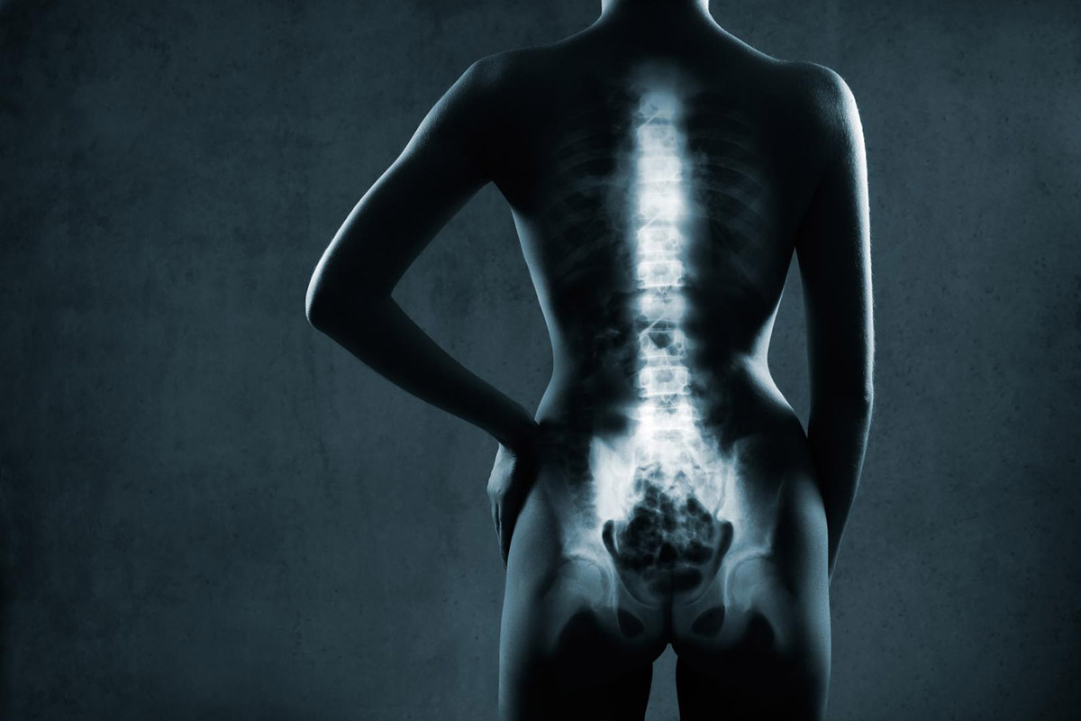 osteodensitometrie