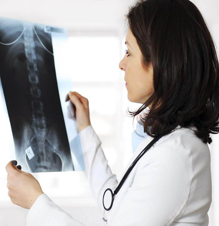 radiographie