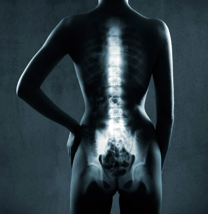 osteodensitometrie