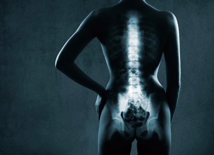 osteodensitometrie